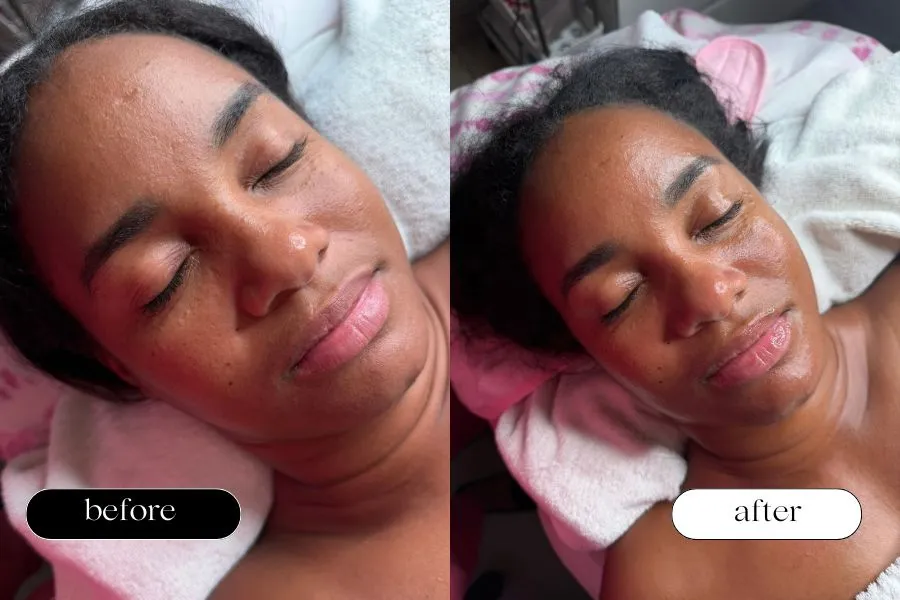 Resultado facial K-Beauty